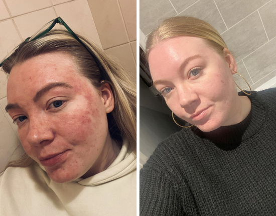Marie D., 27