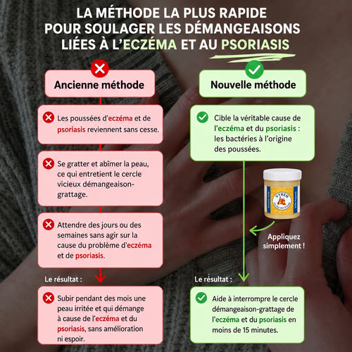 Vyren - Baume Réparateur Eczéma & Psoriasis
