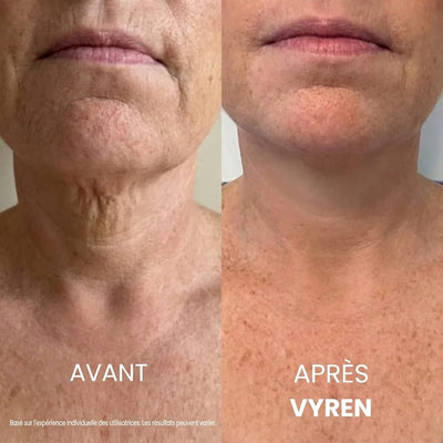 Vyren® Crème Cou Raffermissante & Liftante