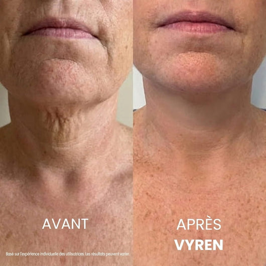 Vyren® Crème Cou Raffermissante & Liftante