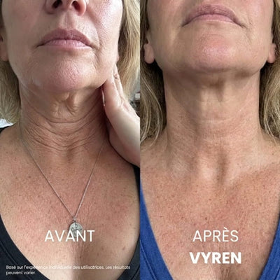 Vyren® Crème Cou Raffermissante & Liftante