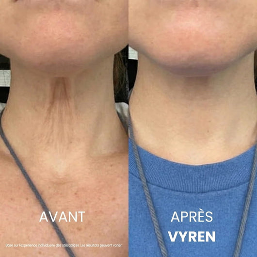 Vyren® Crème Cou Raffermissante & Liftante