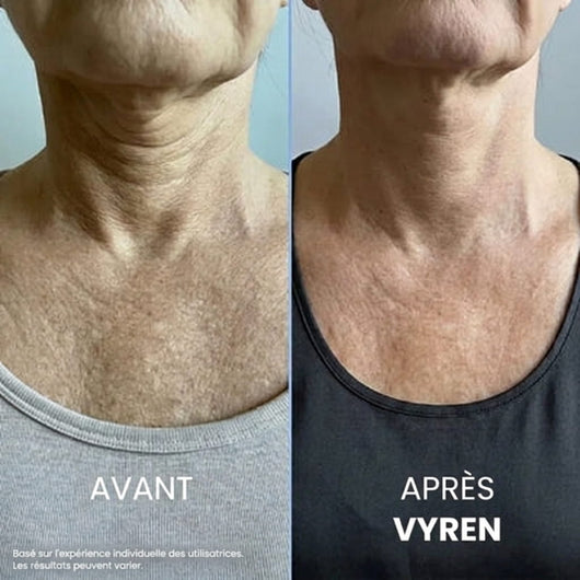 Vyren® Crème Cou Raffermissante & Liftante