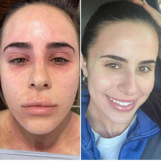 Sara P., 33